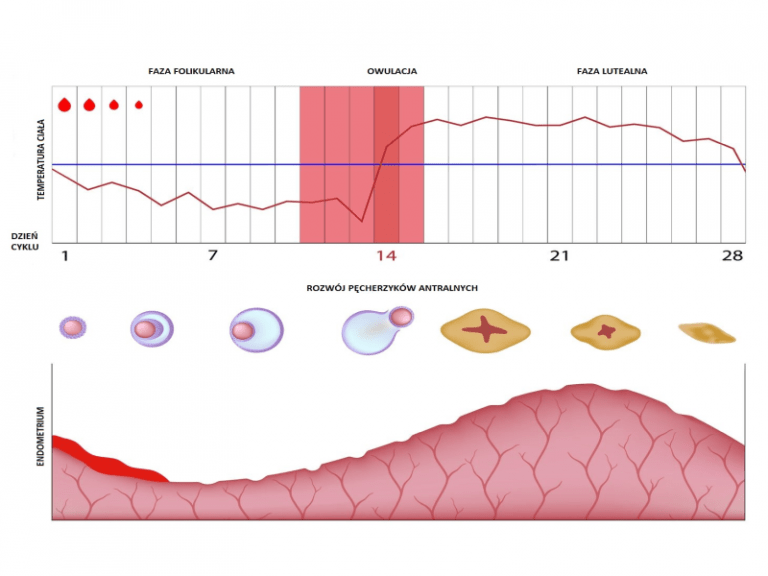 ENDOMETRIAL SCRATCHING ivf abroad gyncentrum.co.uk